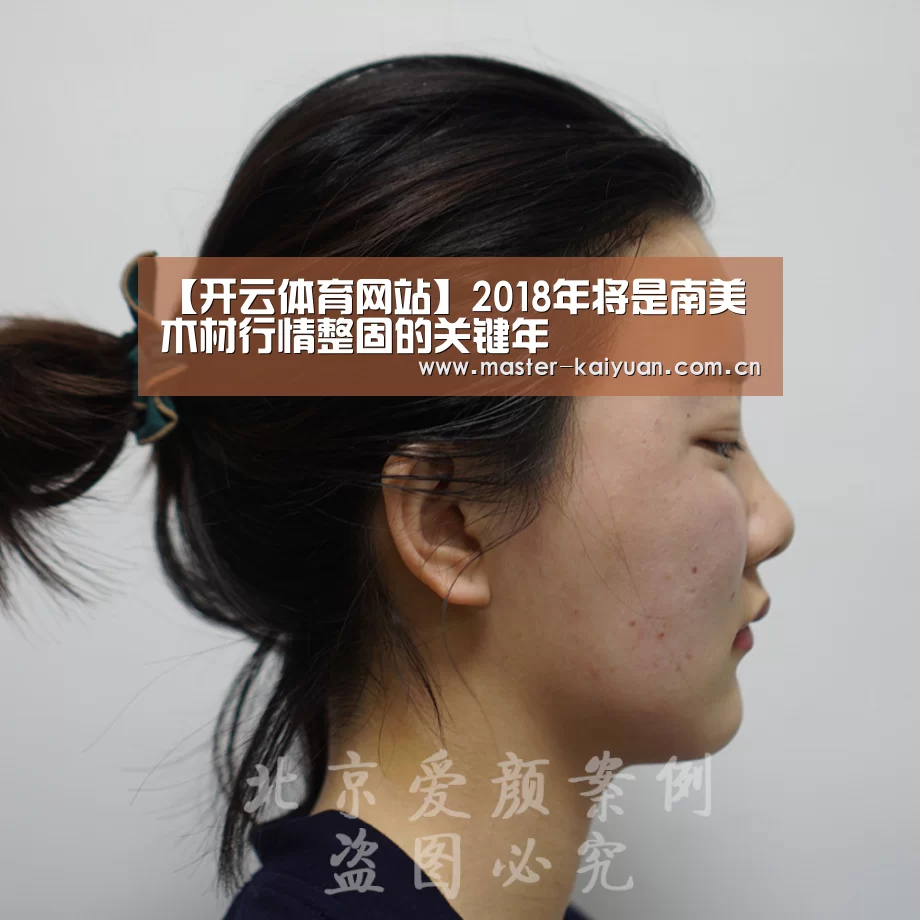 【开云体育网站】2018年将是南美木材行情整固的关键年(图2) 开云体育官网